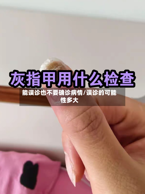 能误诊也不要确诊病情/误诊的可能性多大