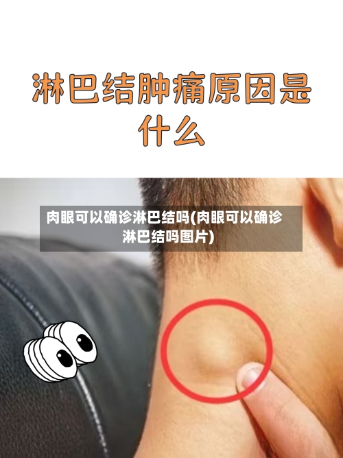 肉眼可以确诊淋巴结吗(肉眼可以确诊淋巴结吗图片)