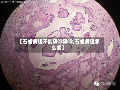 【石蜡病理不能确诊确诊,石蜡病理怎么看】-第3张图片