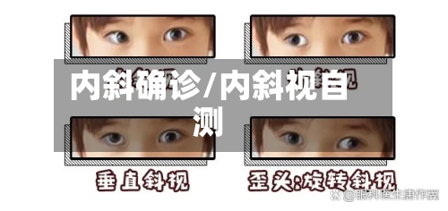 内斜确诊/内斜视自测-第3张图片