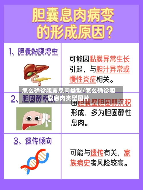 怎么确诊胆囊息肉类型/怎么确诊胆囊息肉类型图片