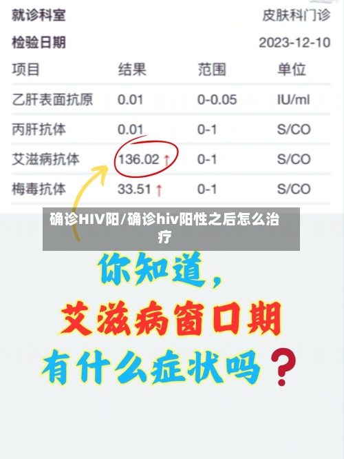 确诊HIV阳/确诊hiv阳性之后怎么治疗-第2张图片