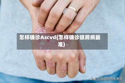 怎样确诊Ascvd(怎样确诊银屑病最准)-第3张图片