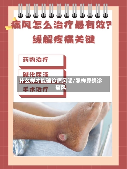 什么样才能确诊痛风呢/怎样算确诊痛风-第2张图片