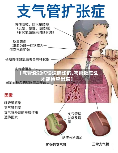 【气管炎如何快速确诊的,气管炎怎么才能检查出来】-第3张图片