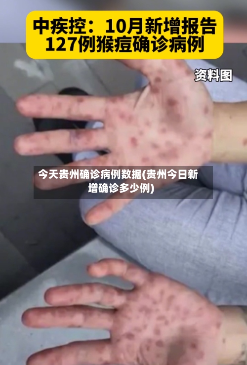 今天贵州确诊病例数据(贵州今日新增确诊多少例)