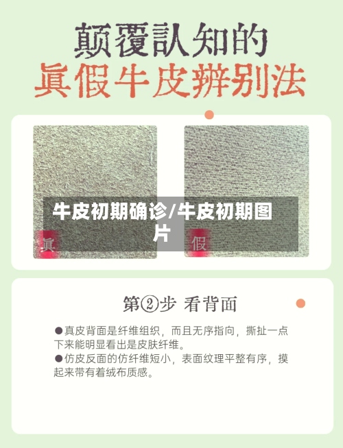 牛皮初期确诊/牛皮初期图片