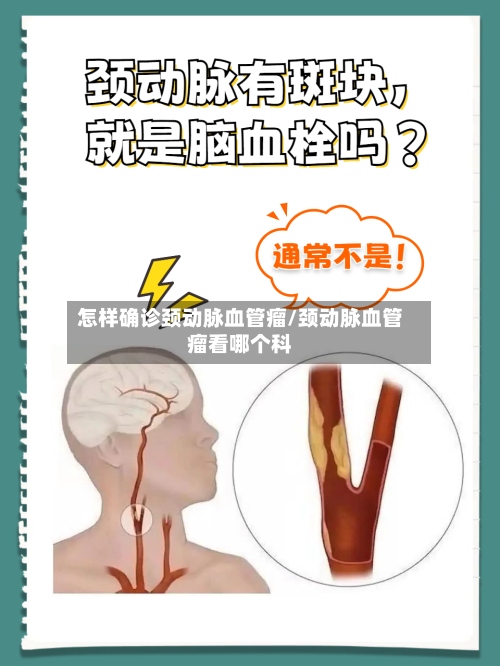 怎样确诊颈动脉血管瘤/颈动脉血管瘤看哪个科-第2张图片