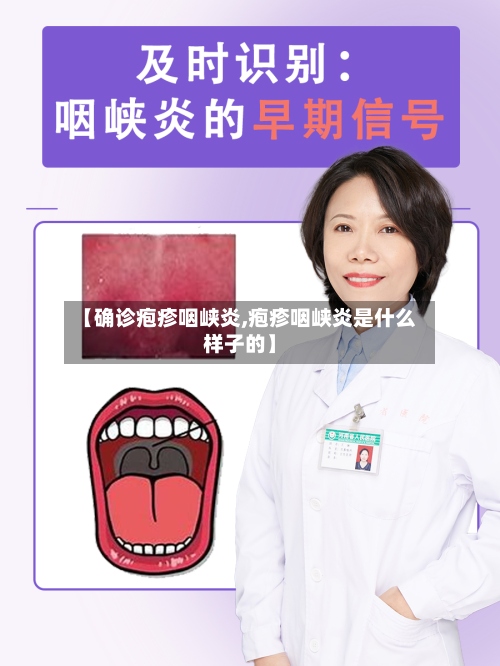 【确诊疱疹咽峡炎,疱疹咽峡炎是什么样子的】-第2张图片