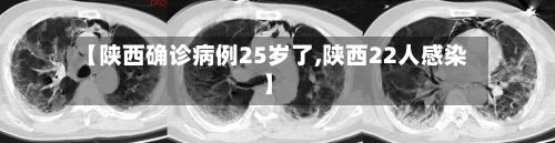 【陕西确诊病例25岁了,陕西22人感染】