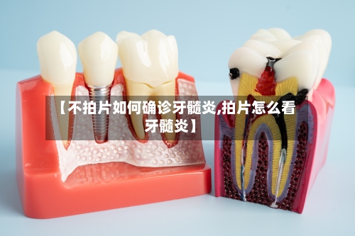 【不拍片如何确诊牙髓炎,拍片怎么看牙髓炎】