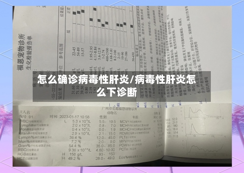 怎么确诊病毒性肝炎/病毒性肝炎怎么下诊断