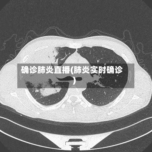 确诊肺炎直播(肺炎实时确诊)-第2张图片