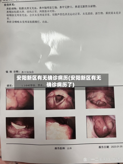 安阳新区有无确诊病历(安阳新区有无确诊病历了)