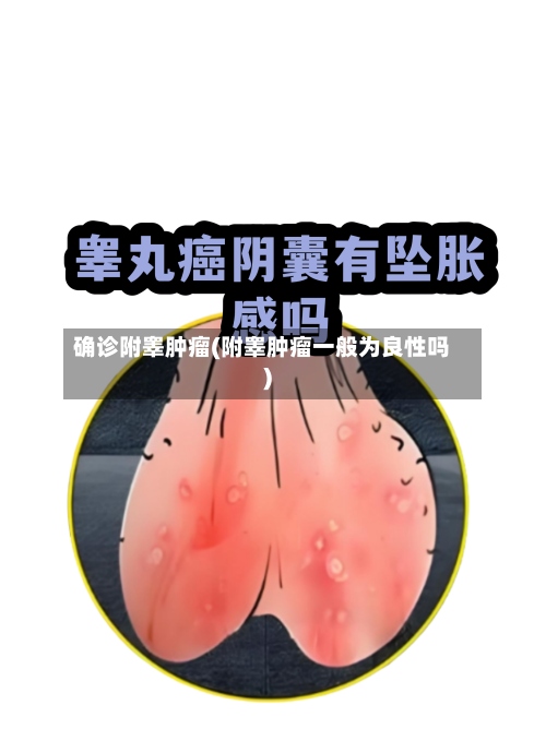 确诊附睾肿瘤(附睾肿瘤一般为良性吗)