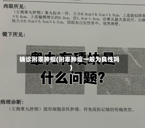 确诊附睾肿瘤(附睾肿瘤一般为良性吗)-第2张图片
