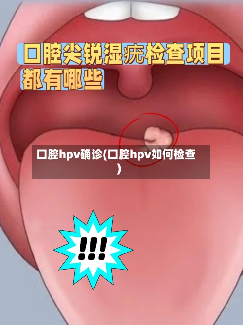 口腔hpv确诊(口腔hpv如何检查)
