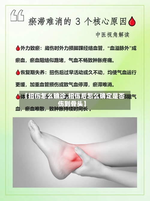 【扭伤怎么确诊,扭伤后怎么确定是否伤到骨头】-第2张图片