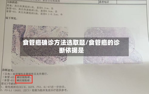 食管癌确诊方法选取题/食管癌的诊断依据是