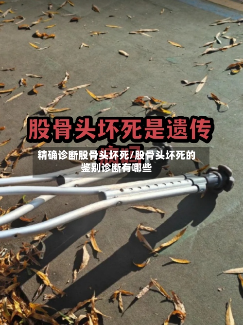 精确诊断股骨头坏死/股骨头坏死的鉴别诊断有哪些-第2张图片