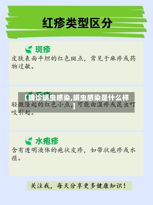 【确诊螨虫感染,螨虫感染是什么样】-第2张图片