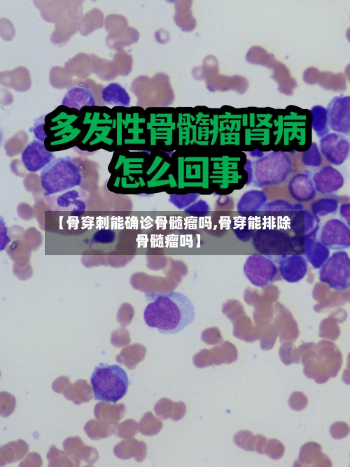 【骨穿刺能确诊骨髓瘤吗,骨穿能排除骨髓瘤吗】