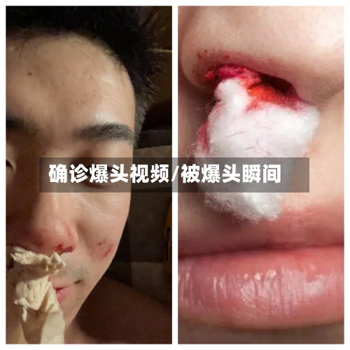 确诊爆头视频/被爆头瞬间