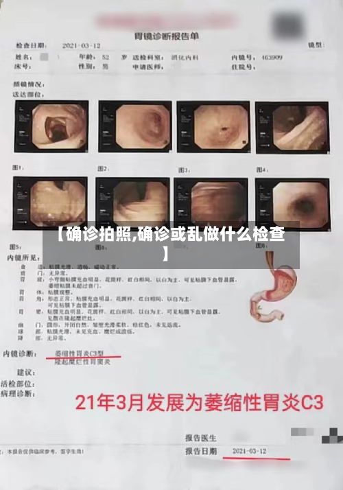 【确诊拍照,确诊或乱做什么检查】-第2张图片