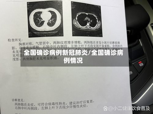全国确诊病例新冠肺炎/全国确诊病例情况-第2张图片