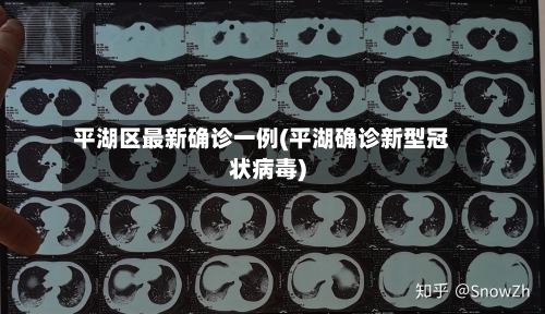 平湖区最新确诊一例(平湖确诊新型冠状病毒)