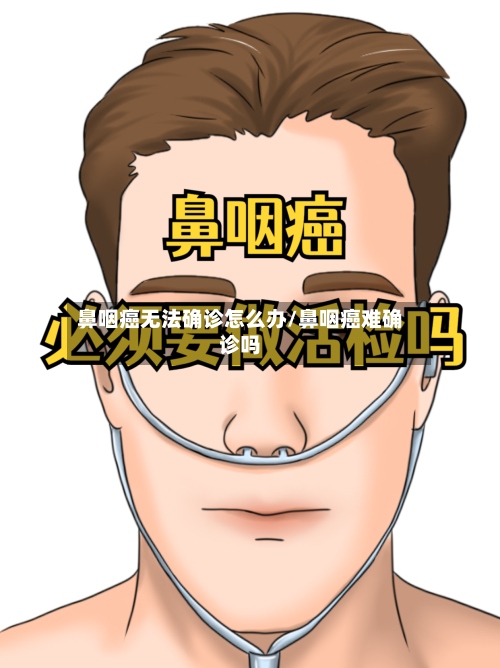 鼻咽癌无法确诊怎么办/鼻咽癌难确诊吗