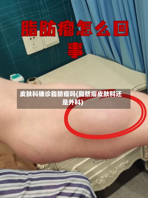 皮肤科确诊脂肪瘤吗(脂肪瘤皮肤科还是外科)-第2张图片