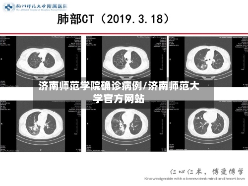 济南师范学院确诊病例/济南师范大学官方网站-第3张图片