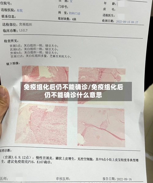 免疫组化后仍不能确诊/免疫组化后仍不能确诊什么意思-第2张图片