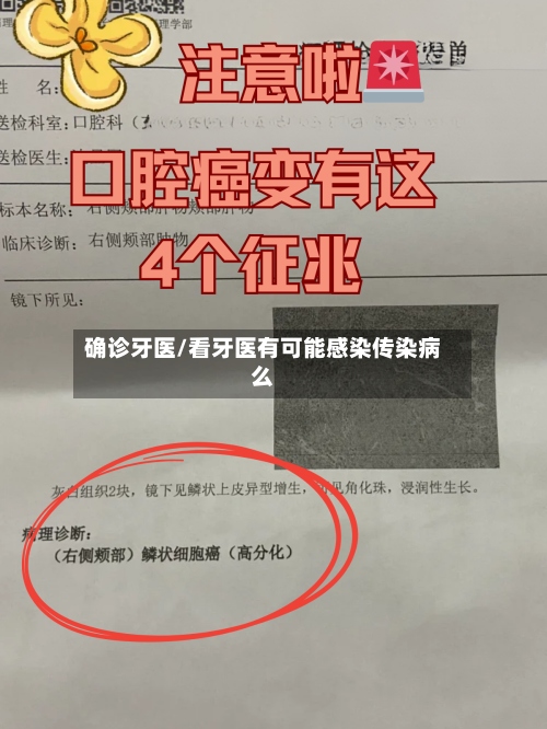 确诊牙医/看牙医有可能感染传染病么