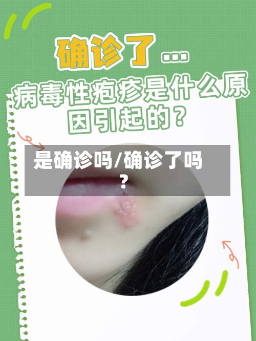 是确诊吗/确诊了吗?-第2张图片