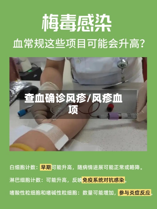 查血确诊风疹/风疹血项-第3张图片