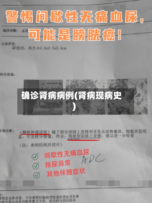 确诊肾病病例(肾病现病史)