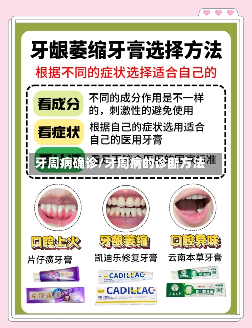 牙周病确诊/牙周病的诊断方法-第2张图片
