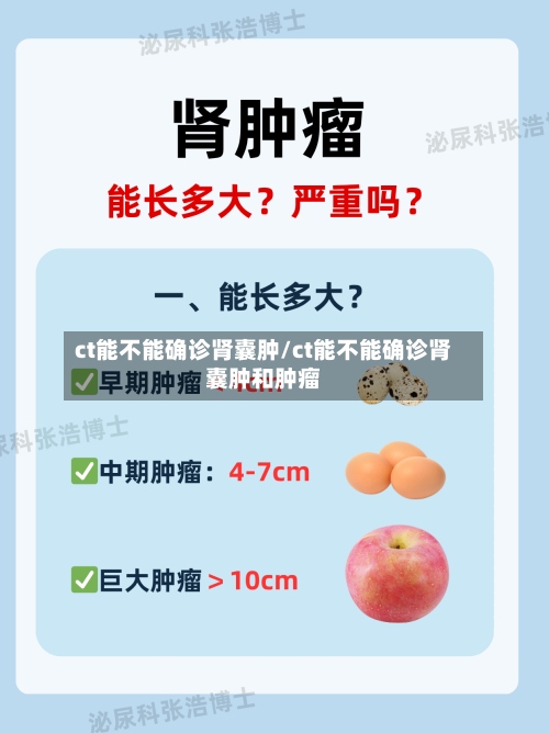 ct能不能确诊肾囊肿/ct能不能确诊肾囊肿和肿瘤-第2张图片