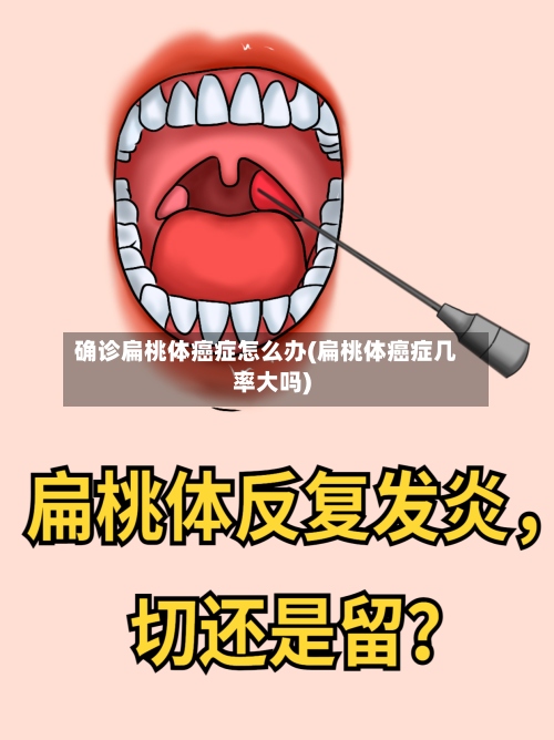 确诊扁桃体癌症怎么办(扁桃体癌症几率大吗)-第3张图片