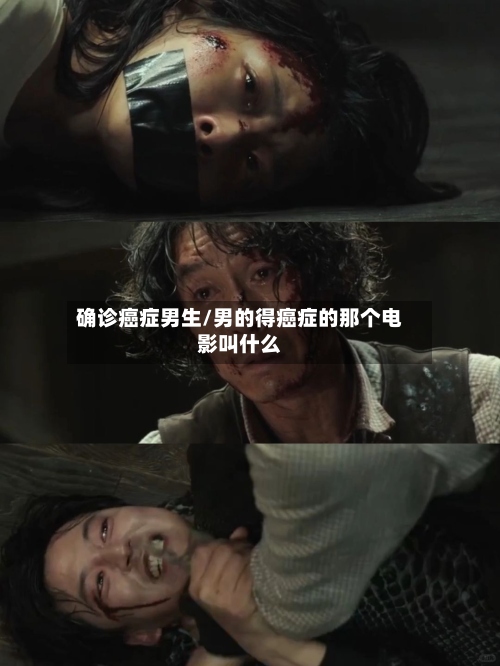 确诊癌症男生/男的得癌症的那个电影叫什么-第3张图片