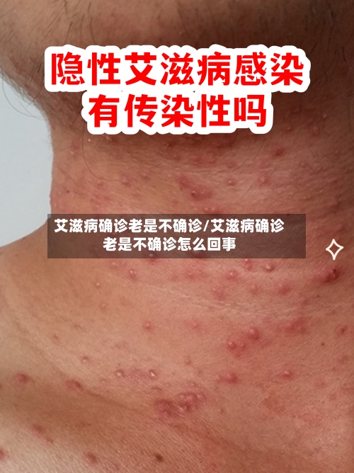 艾滋病确诊老是不确诊/艾滋病确诊老是不确诊怎么回事