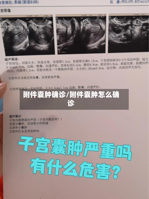 附件囊肿确诊/附件囊肿怎么确诊-第2张图片