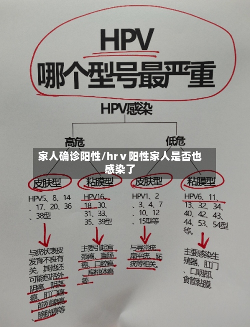 家人确诊阳性/hrⅴ阳性家人是否也感染了-第3张图片