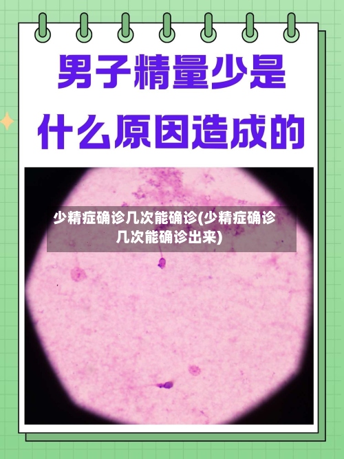 少精症确诊几次能确诊(少精症确诊几次能确诊出来)-第2张图片