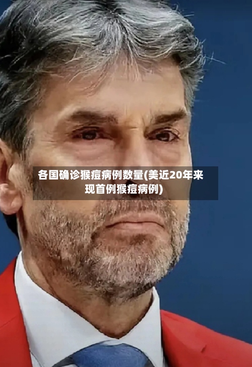 各国确诊猴痘病例数量(美近20年来现首例猴痘病例)-第3张图片