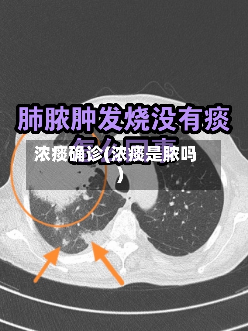 浓痰确诊(浓痰是脓吗)-第2张图片