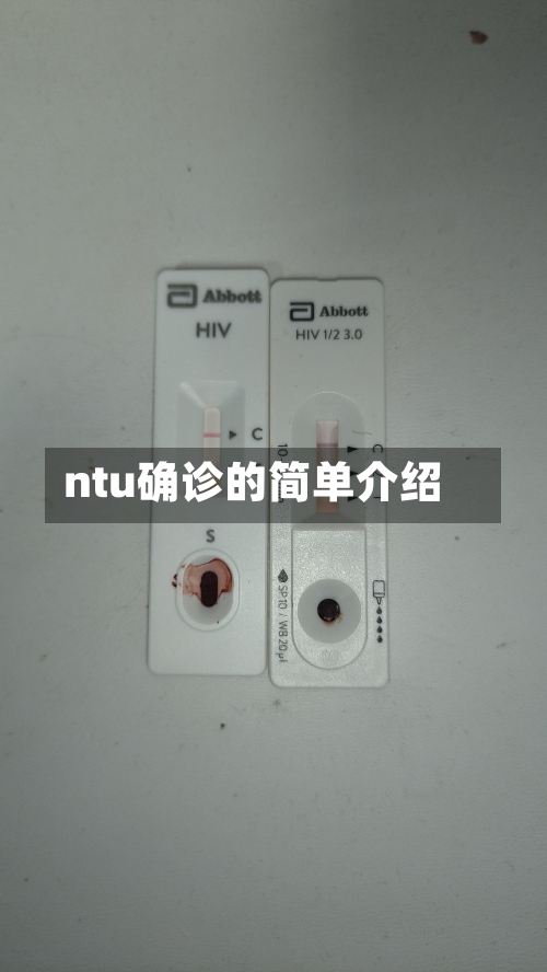 ntu确诊的简单介绍-第2张图片