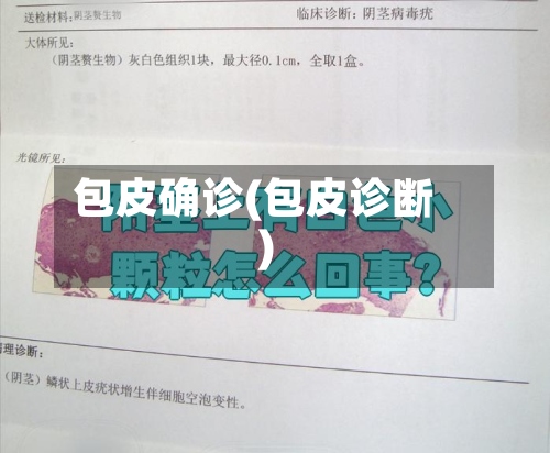 包皮确诊(包皮诊断)-第2张图片